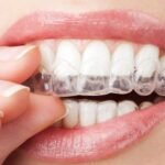 Invisible Aligners Cost in India: A Realistic Guide Before You Decide