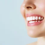 Top-Rated Smiles
